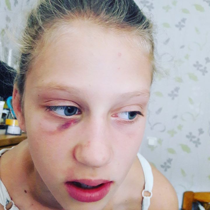 placeholder-Images-Oxymaven-Tall